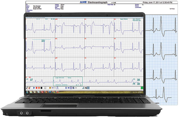 ECG Software